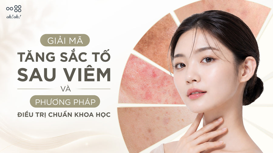 What is post-inflammatory hyperpigmentation? Mechanism and skincare