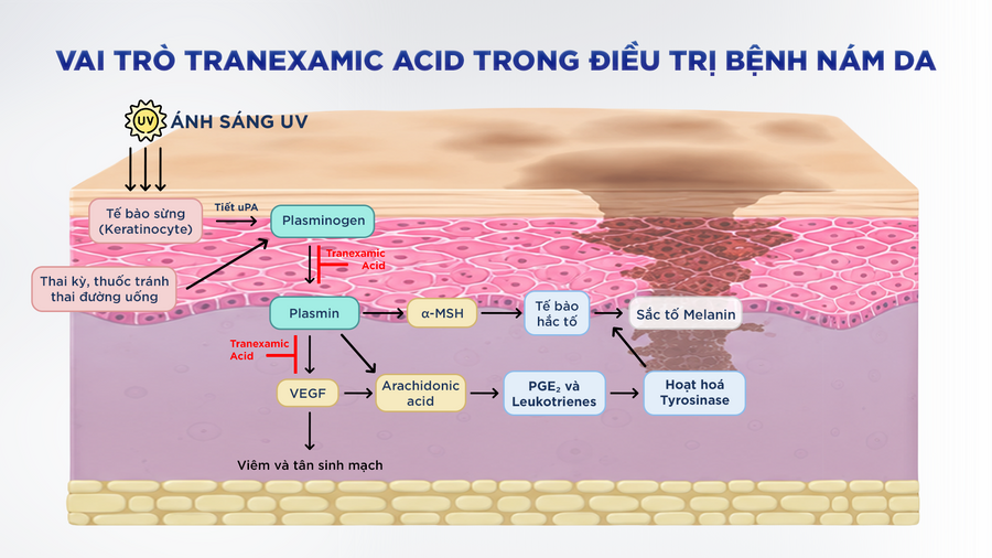 Tranexamic acid and how dark spots form on the skin