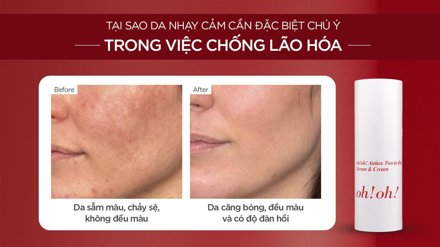 WHY SENSITIVE SKIN REQUIRES SPECIAL ATTENTION IN ANTI-AGING?