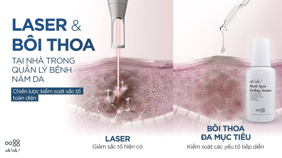 At-home skincare after an aesthetic laser procedure