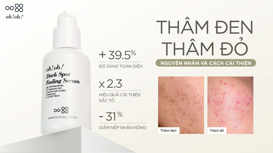 POST-ACNE DARK SPOTS AND RED SPOTS: CAUSES AND SOLUTIONS